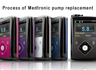 Process of Medtronic pump replacement