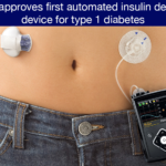 medtronic-670g-insulin-pump